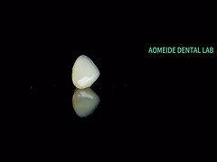 Keramische kroonbrug