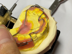 Op maat gemaakte orthodontische apparatuur met goede vasthoudbaarheid en verstelbare kenmerken