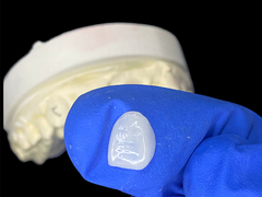 IPS e.max Finissen voor snijtanden in de kleur A1 Natuurlijke esthetiek voor een vlekkeloze glimlach