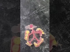 Nesbit Flexible Partial Denture voor comfort en duurzaamheid bij tandvervanging