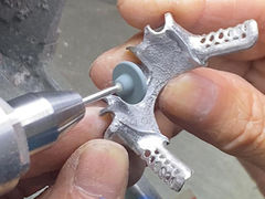 Gegooid gedeeltelijk tandvlees