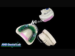 Een compleet assortiment op maat gemaakte orthodontische oplossingen, vervaardigd met precisie, comfort en zorg.