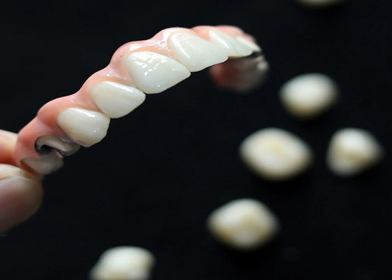 kopen Esthetische oplossing Tandheelkundige implantaten Kroonbrug voor volwassenen Vervanging van ontbrekende tanden online manufacture
