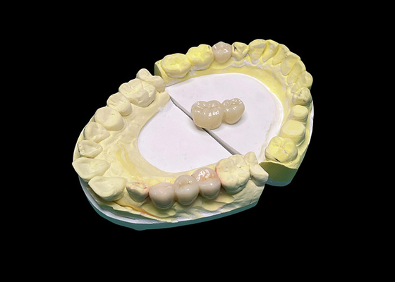 kopen Advanced Translucency Ceramic Crowns and Bridges Enhance Your Smile with Precision and Natural Aesthetics for Long-lasting Durability (Geavanceerde doorzichtige keramische kronen en bruggen verbeteren je glimlach met precisie en natuurlijke esthetiek voor langdurige duurzaamheid) online manufacture