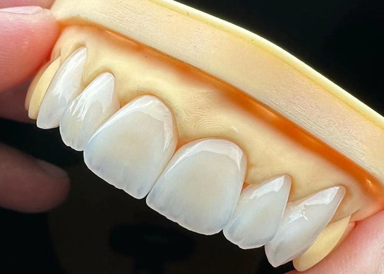 kopen Hoge sterkte volle keramische kroonbrug met uitzonderlijke biocompatibiliteit voor langdurige duurzaamheid online manufacture