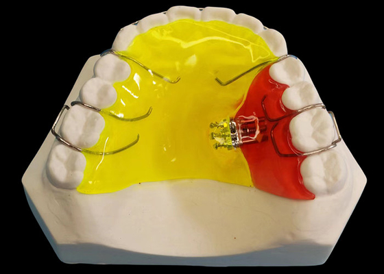 kopen Drie richting verwijderbare orthodontische apparaten voor klantvereisten tegen concurrerende prijzen online manufacture
