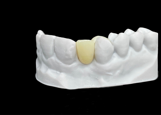 kopen Splitsingsbestand Zirconia tandkronijn met uitzonderlijke sterkte en doorschijnendheid online manufacture
