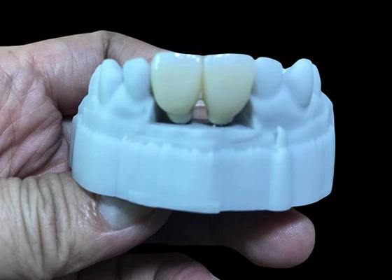 kopen Vervang de ontbrekende tand tandheelkundige implantaat kroon met schroef titanium basis en Zirconia kroon online manufacture