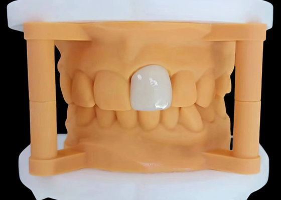 kopen Translucide zirconia tandkronijn met esthetische prestaties van China Dental Lab online manufacture