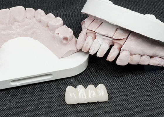 kopen Premium Zirconia tandkronen voor superieure sterkte en natuurlijke esthetiek online manufacture