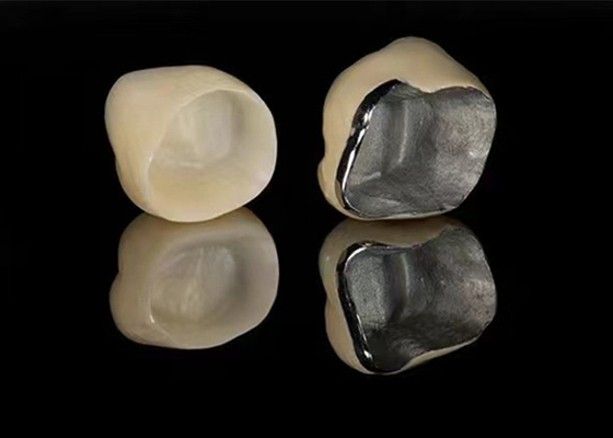 kopen Natuurlijk uitziend porselein gesmolten met metalen kroon voor het herstellen van beschadigde tanden online manufacture
