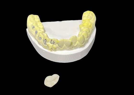 kopen Op maat gemaakte tandheelkundige keramische inleg en inleg voor hersteloplossingen en reparatie van beschadigde tanden online manufacture