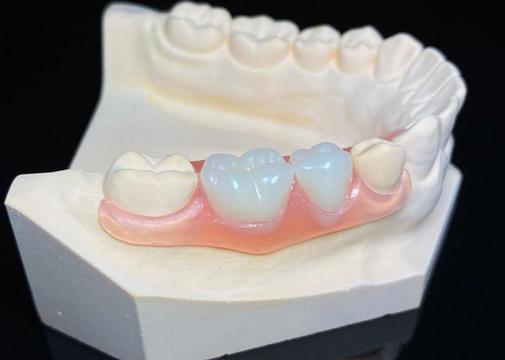 kopen OEM Onzichtbare verwijderbare tandheelkundige prothesen Custom Acrylhars gedeeltelijke tandheelkundige prothese online manufacture