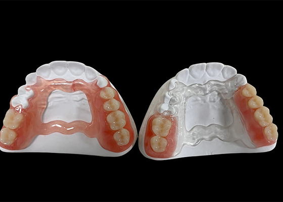kopen Een gedeeltelijk verwijderbare tandheelkundige prothese, een verwijderbare tandprothese voor kauwen en praten. online manufacture