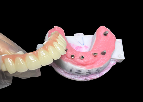 kopen Implantat ondersteund Volledig booggebit Vaste tandheelkundige implantaten Keramische kroonbrug online manufacture