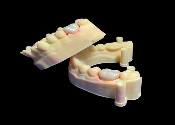 kopen Biocompatibele tandheelkundige circonia kroon voor enkele / meerdere tanden hoge sterkte online manufacture