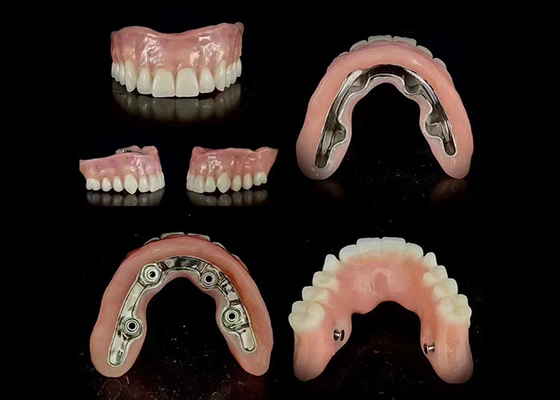 kopen Precise Bar Implantate Supported Hybrid Prothese Beveiligde pasvorm Verstelbare stabiliteit online manufacture