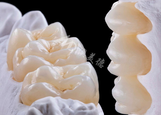 kopen Hoge sterkte zirconia tandkronen voor vervanging van een of meerdere tanden online manufacture