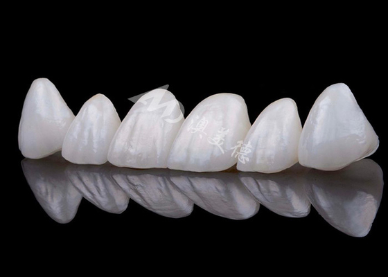kopen Natuurlijke uitstraling Zirconia tandkroon Vlekwerend Alle Zirconia kroon online manufacture