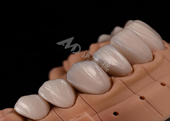 kopen Sterkte Natuurlijke esthetiek Tanden Zirconia kronen voor precieze chipweerstand online manufacture
