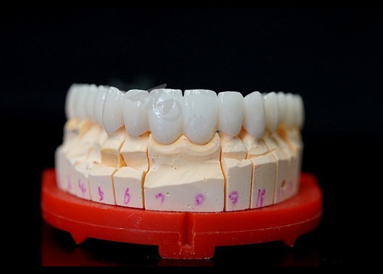 kopen Precieze Zirconia kronen, zeer biologisch compatibele Zirconia kronen voor tanden. online manufacture