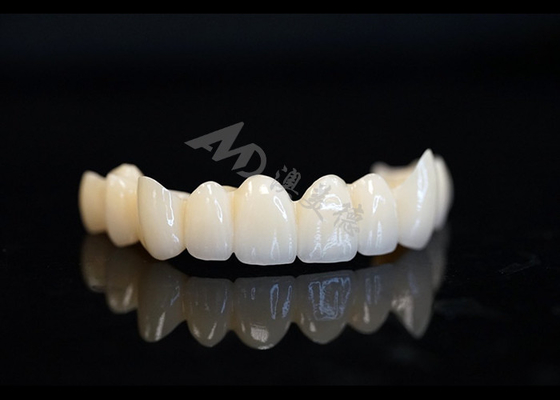 kopen Precieze gemaakt solide zirconia kroon voor perfecte tandheelkundige pasvorm en comfort online manufacture