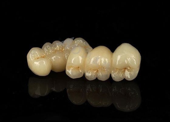 kopen Vlekbestendige vaste zirconia kroon met uitstekende biologische compatibiliteit online manufacture