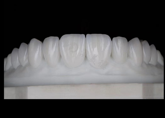kopen Translucide natuurlijke esthetische circonia kronen uitstekende biocompatibiliteit en sterkte online manufacture