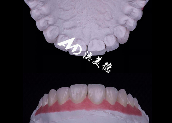 kopen Translucide EMAX porseleinen fineer Vlekbestendig / Sterkte online manufacture