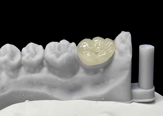 kopen Precieze tandheelkundige keramische inleg, porseleinen inleg en inleg goedgekeurd door de FDA. online manufacture