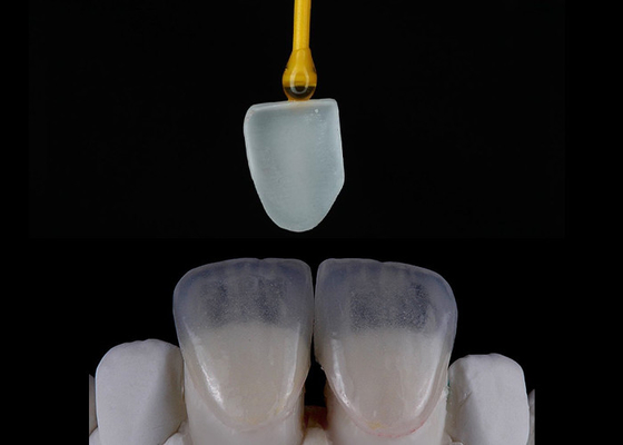 kopen Op maat gemaakt tandheelkundige restauratie EMAX veneers Prachtig uitgelijnd digitale afdruk online manufacture