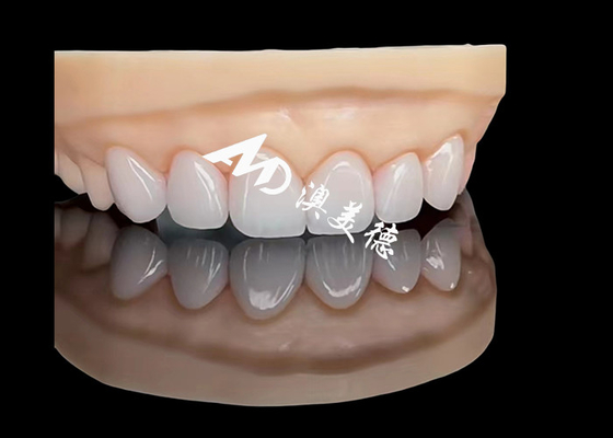 kopen Porselein EMAX Veneer Hoog nauwkeurige esthetische restauratie met superieure duurzaamheid online manufacture