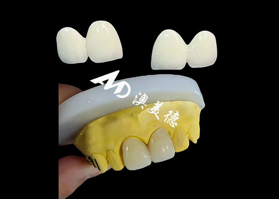 kopen Custom Zirconia tandheelkundige kroon Precise Fit Tand Cap uit China tandheelkundig lab online manufacture