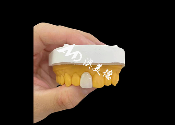kopen Voorste snijtand Zirconia Tandkrans Natuurlijk uitziende hoge sterkte slijtvastheid online manufacture
