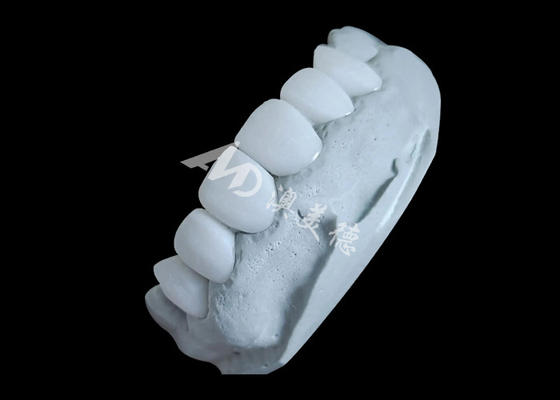 kopen Zirconia tandkronen leveren onverslaanbare kracht en natuurlijke gladheid, en natuurlijke doorschijnendheid. online manufacture