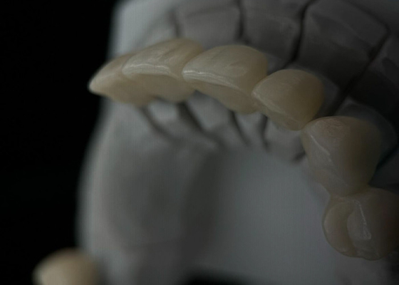 kopen Fit monolithische zirconia tandkroon met doorschijnendheid en weerstand online manufacture