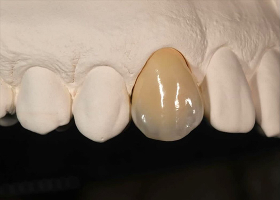 kopen Vlekwerend vermogen Vaste Zirconia kroon voor voortanden achtertanden online manufacture