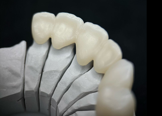 kopen Tandheelkundige kroon van zirkonium met uitstekende sterkte en natuurlijke esthetiek online manufacture