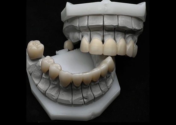 kopen Tandheelkundige kronen van zirconia voor enkele of meerdere tanden online manufacture