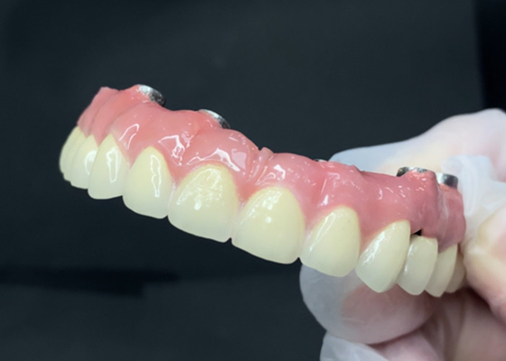 kopen Duurzame tandheelkundige implantaten met makkelijk schoon te maken titanium onderstel en circonia kroon online manufacture