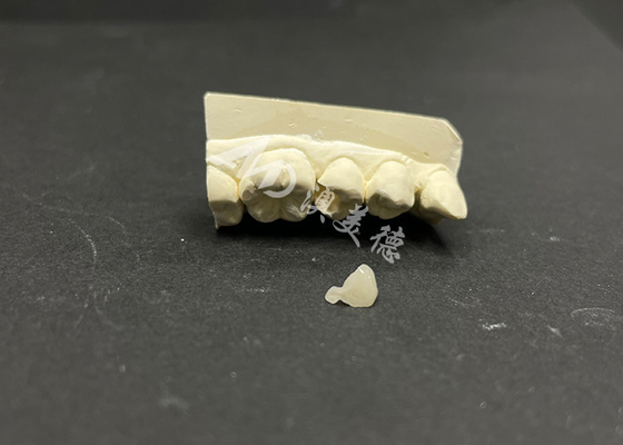 kopen Hypoallergeen vlekbestendig Emax keramisch inlegmateriaal voor nauwkeurige reparatie van beschadigde tanden online manufacture