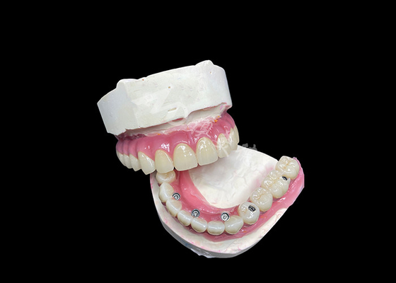 kopen Zirkonium tandheelkundige implantaten, kroonbrug op de zesde verdieping voor ontbrekende tanden. online manufacture