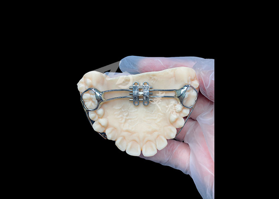 kopen MSE palatal expander Innovatieve orthodontische apparaten voor een effectieve tandbalans online manufacture