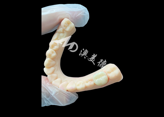 kopen Hoge sterkte keramische Zirconia achterste tandkronijn superieure esthetiek en duurzaamheid online manufacture