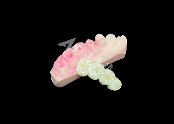 kopen Superieure solide zirconia kroonbrug voor natuurlijke tandheelkundige esthetiek online manufacture