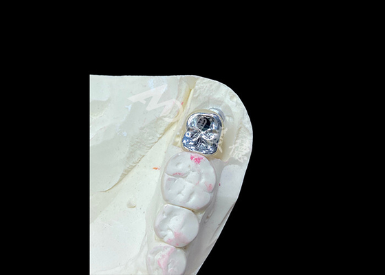 kopen Tandheelkundige kroon met een titanium afbouw en een met metaal gesmolten porselein-PFM kroon online manufacture