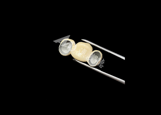 kopen Precies geschikt porselein gesmolten met metaalkroon met uitstekende biocompatibiliteit online manufacture