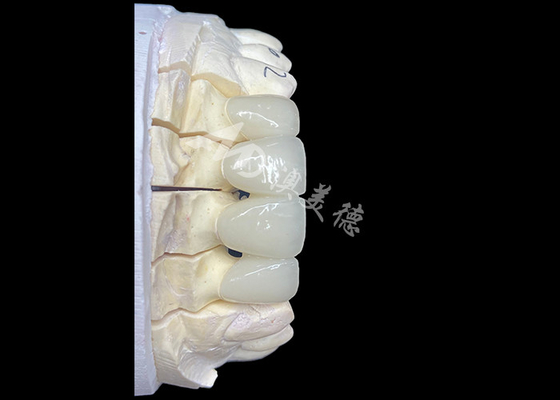 kopen De natuurlijke circonia-keramische kroonbrug biedt precisie en esthetiek gecombineerd online manufacture