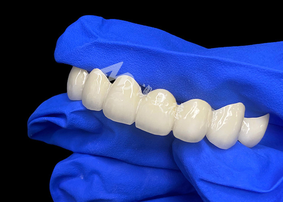 kopen Hoge doorschijnendheid Lava Zirconia Tandbrug naadloze mix met natuurlijke tanden online manufacture