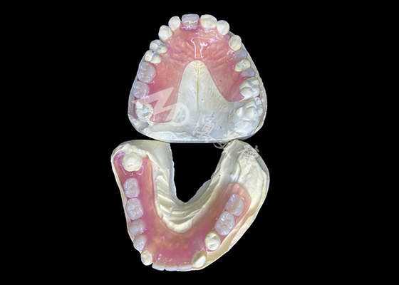 kopen Valplast flexibele gedeeltelijke tandheelkunde voor ultiem comfort en esthetische aantrekkingskracht online manufacture